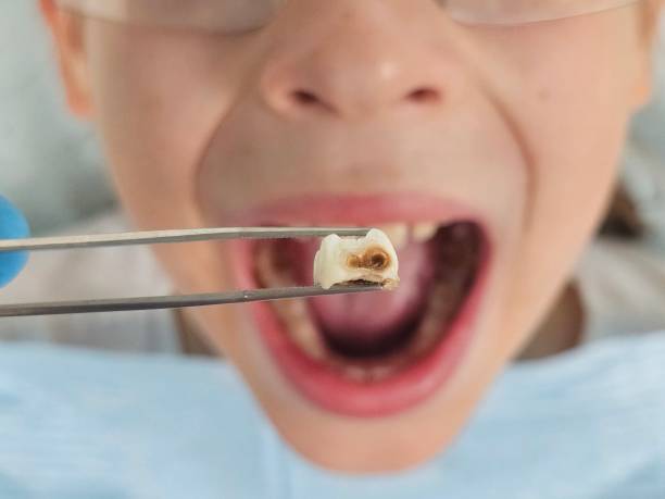 Best Cosmetic Emergency Dentistry in Harlan, KY