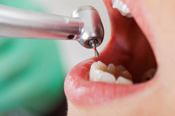 Best Weekend Emergency Dentist in Harlan, KY